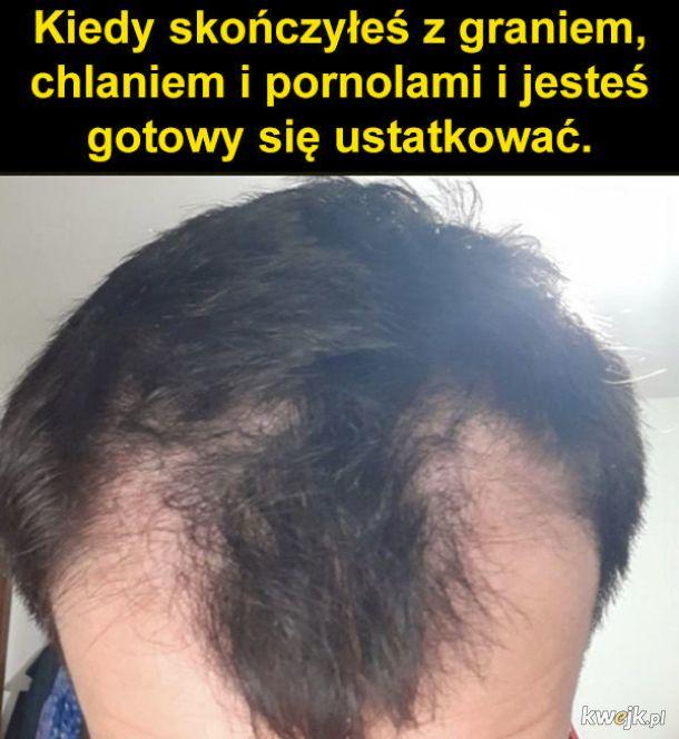 Korea Płd. dyskutuje, czy leczenie łysienia powinno być częścią ochrony zdrowia